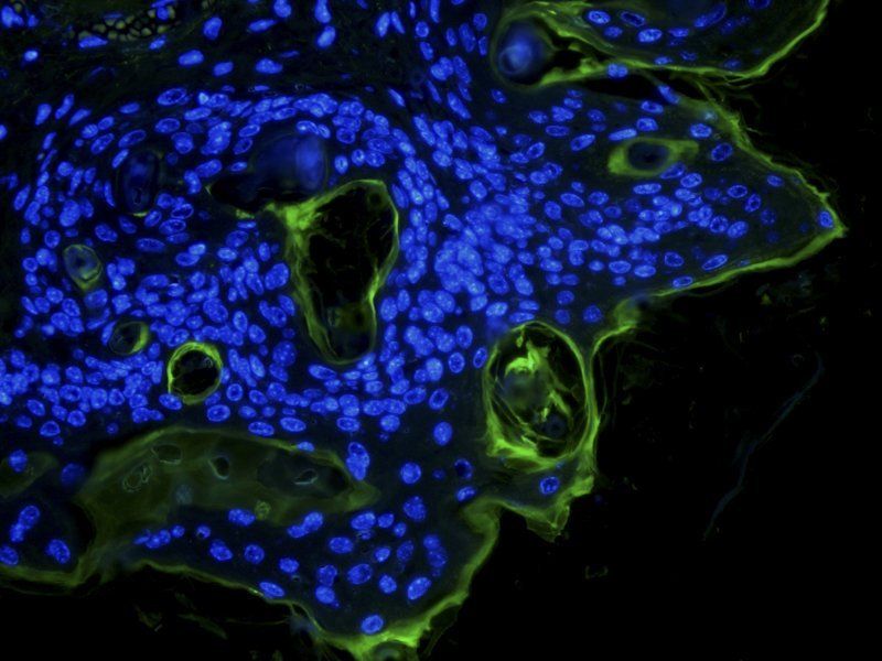 IL6 Rabbit Polyclonal Antibody (FITC)