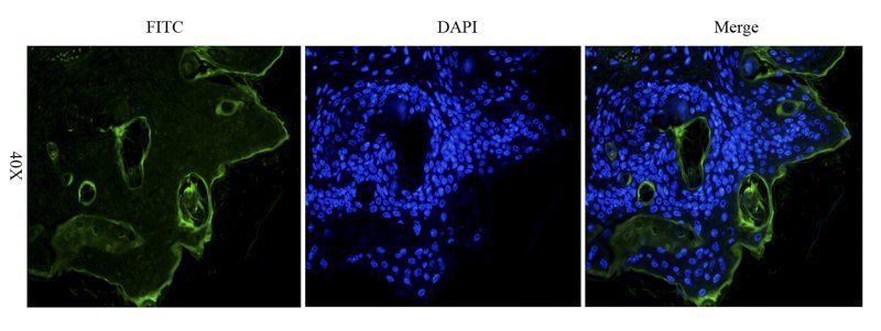 IL6 Rabbit Polyclonal Antibody (FITC)