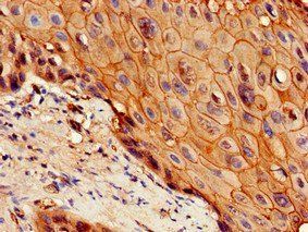 IL7R Antibody