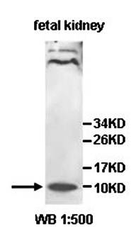 IL8 Rabbit Polyclonal Antibody