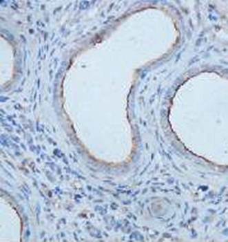 IL8 Rabbit Polyclonal Antibody