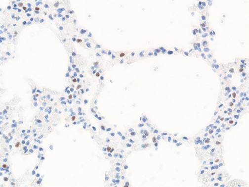 VCAM1 Rabbit Polyclonal Antibody
