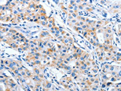 IMMT Antibody