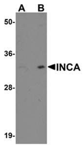 INCA1 Rabbit Polyclonal Antibody