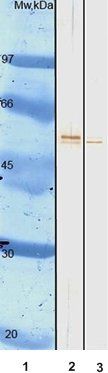 Influenza A Monoclonal Antibody (Detection)