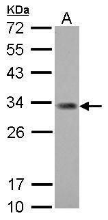 NME5 Rabbit Polyclonal Antibody