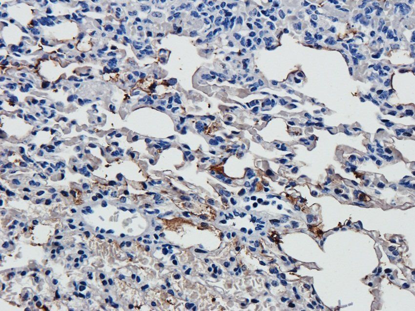 iNOS Rabbit Polyclonal Antibody