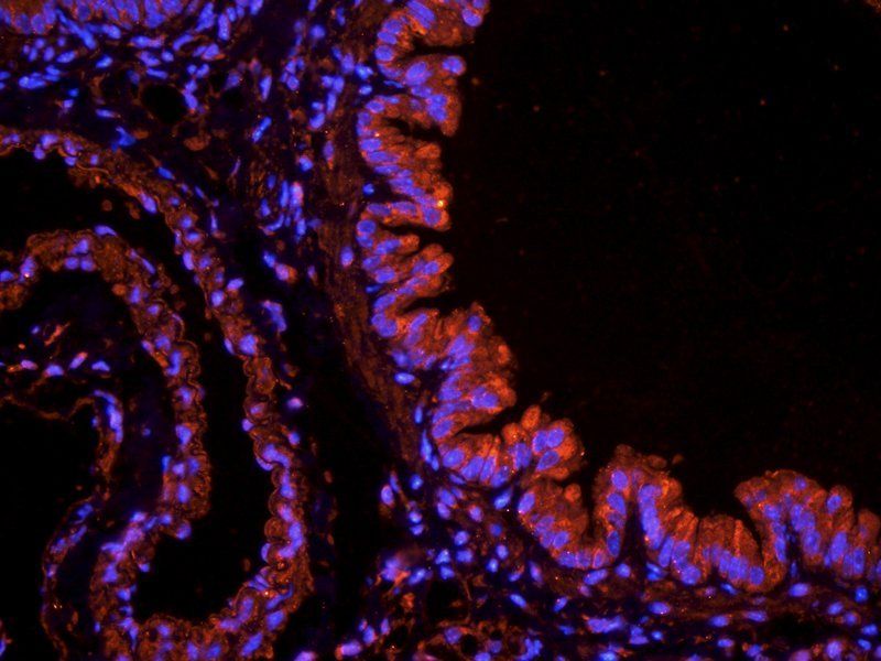 iNOS Rabbit Polyclonal Antibody
