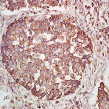 Phospho-Insulin Receptor Beta (Tyr1185) Rabbit Polyclonal Antibody