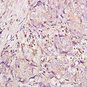 Integrin alpha 4+Beta 7 Rabbit Polyclonal Antibody