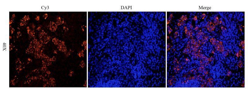 Integrin alpha 4 Rabbit Polyclonal Antibody