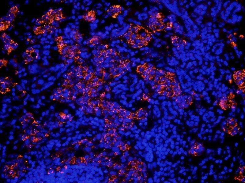 Integrin alpha 4 Rabbit Polyclonal Antibody