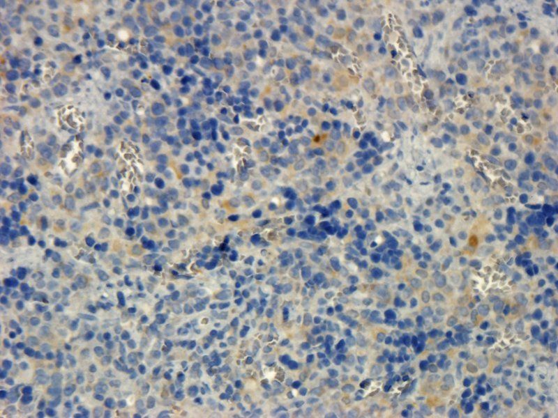 Integrin alpha 4 Rabbit Polyclonal Antibody