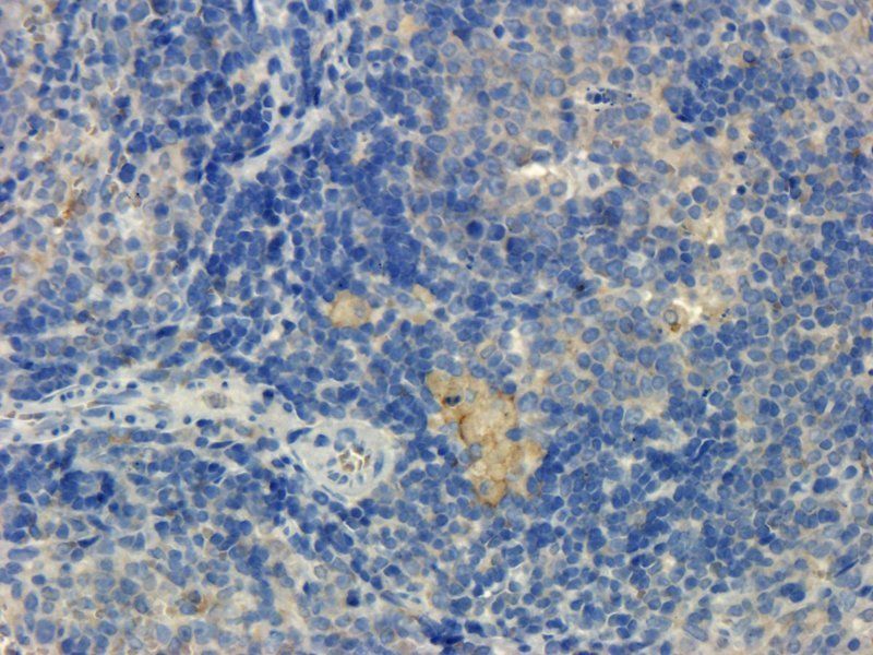 Integrin alpha 4 Rabbit Polyclonal Antibody