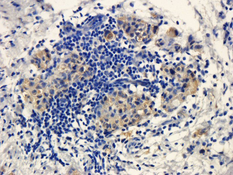 Integrin alpha 4 Rabbit Polyclonal Antibody