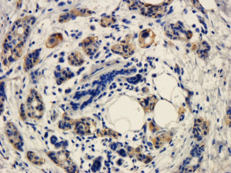 Integrin alpha 4 Rabbit Polyclonal Antibody
