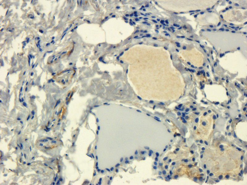 Integrin alpha 4 Rabbit Polyclonal Antibody