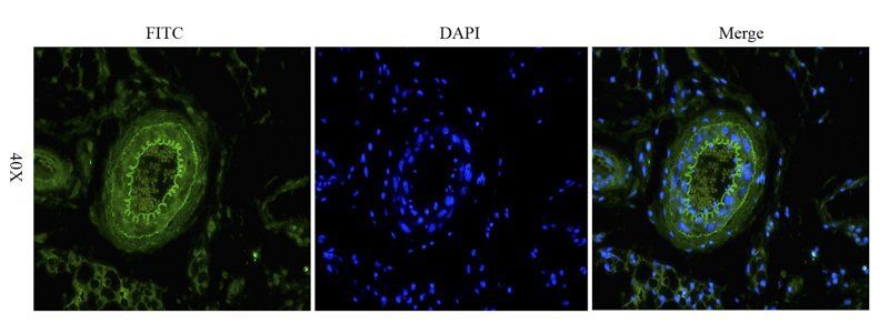 Integrin alpha 5 Rabbit Polyclonal Antibody (FITC)