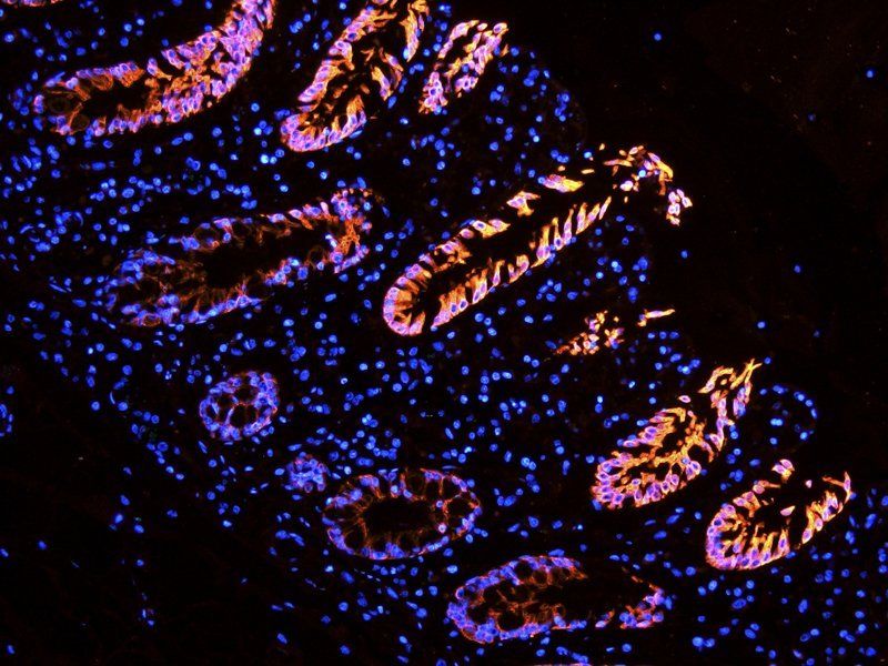 Integrin alpha 5 Rabbit Polyclonal Antibody