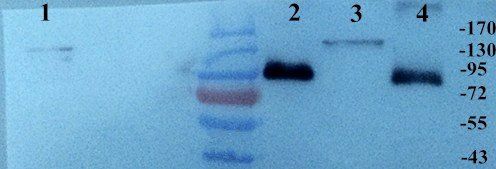 Integrin alpha 5 Rabbit Polyclonal Antibody