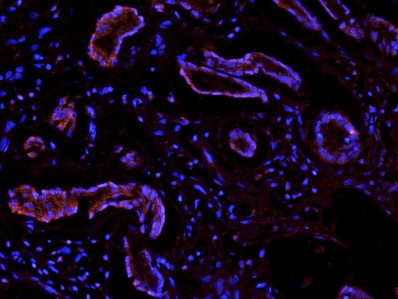 Integrin beta 1 Rabbit Polyclonal Antibody