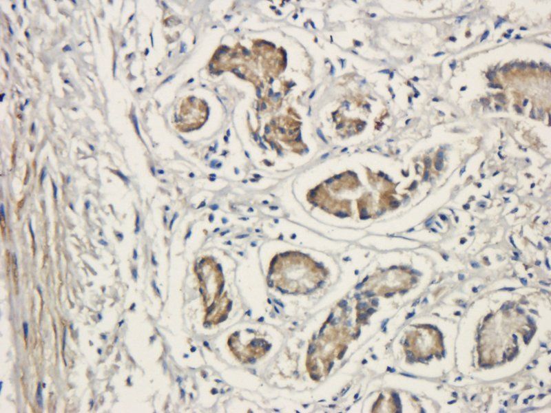 Integrin beta 1 Rabbit Polyclonal Antibody