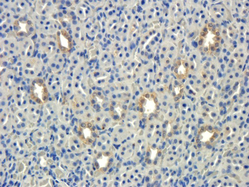 Integrin beta 7 Rabbit Polyclonal Antibody