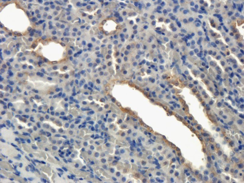 Integrin beta 7 Rabbit Polyclonal Antibody
