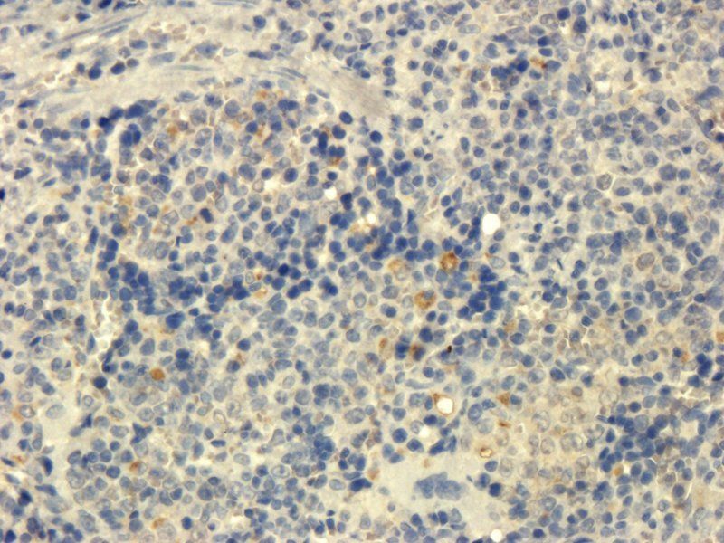 Integrin beta 7 Rabbit Polyclonal Antibody