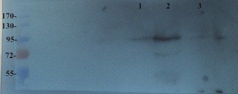 Integrin beta 7 Rabbit Polyclonal Antibody