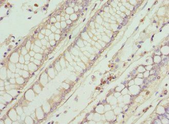 IFNB1 Antibody