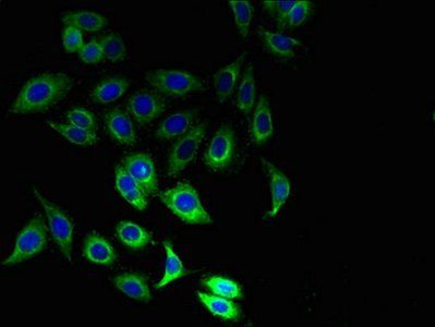 IFITM1 Antibody