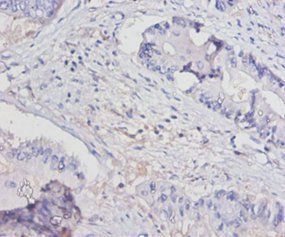 IL15 Antibody