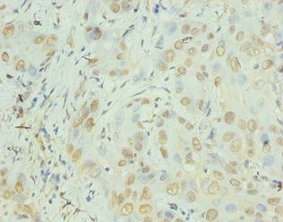 CXCL8 Antibody