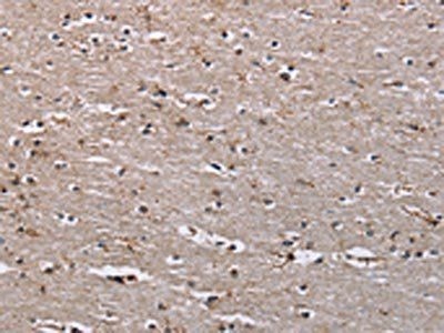 IQCJ Antibody