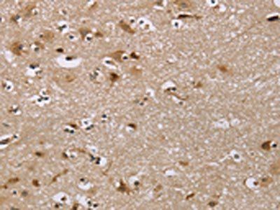 IQCJ Antibody