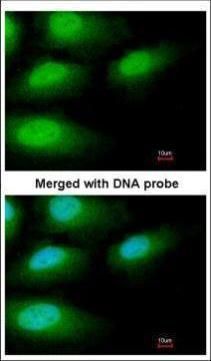 IRAK3 Rabbit Polyclonal Antibody