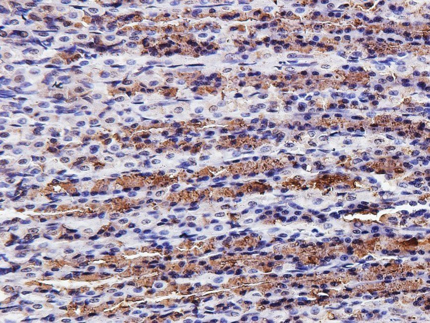 IRAK4 Rabbit Polyclonal Antibody