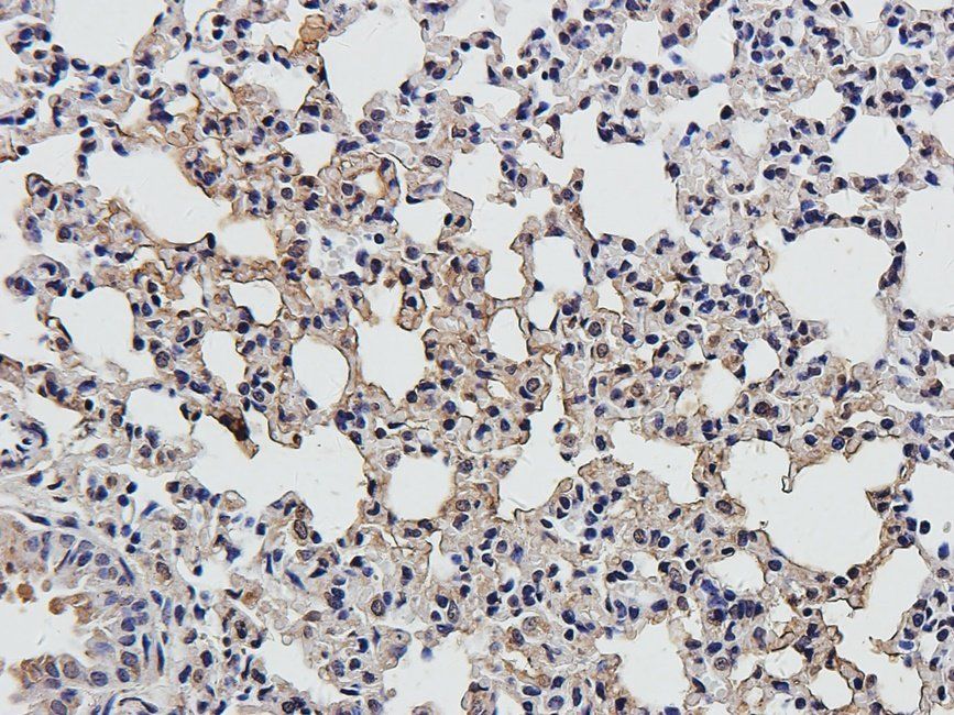 IRAK4 Rabbit Polyclonal Antibody
