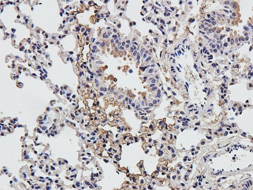 IRAK4 Rabbit Polyclonal Antibody