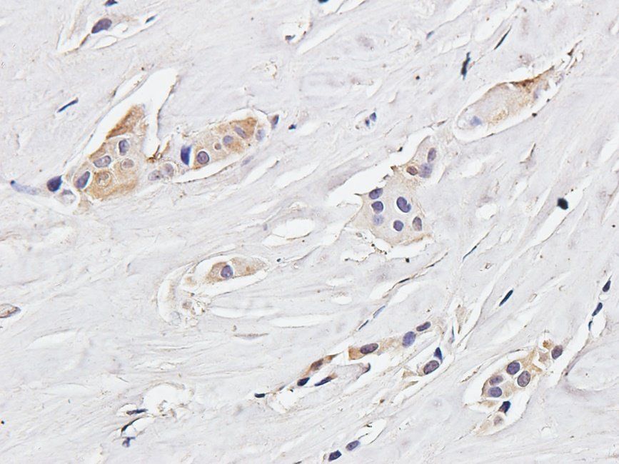 IRAK4 Rabbit Polyclonal Antibody
