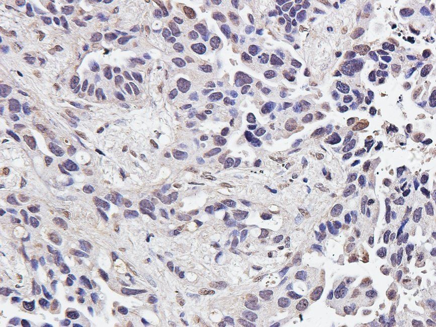 IRAK4 Rabbit Polyclonal Antibody