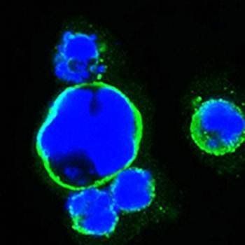 ISL1 Antibody