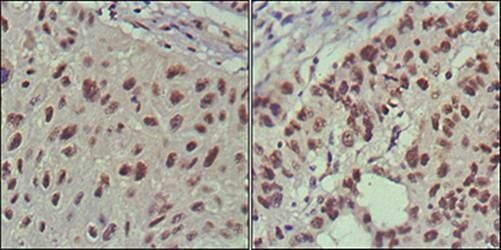 ISL1 Antibody