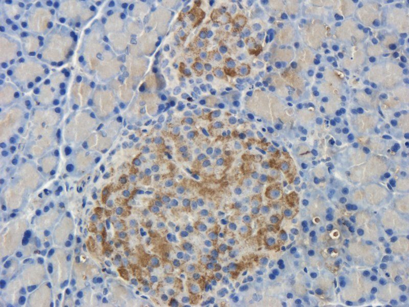 Islet 1 Rabbit Polyclonal Antibody
