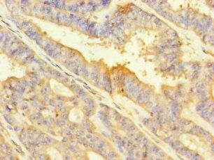 ITGA2 Antibody