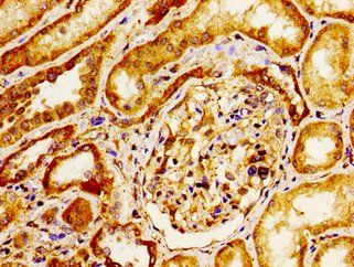 ITGAV Antibody