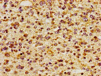 ITGAV Antibody