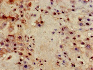 ITGB4 Antibody