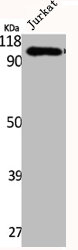 ITGB5 Antibody